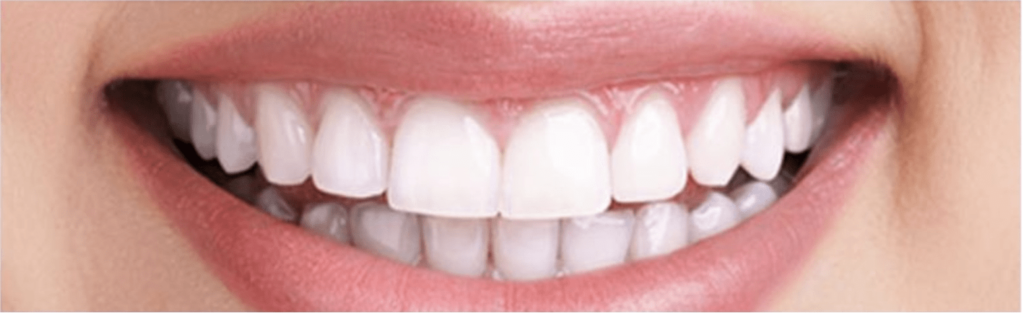 Close up white smile front on after