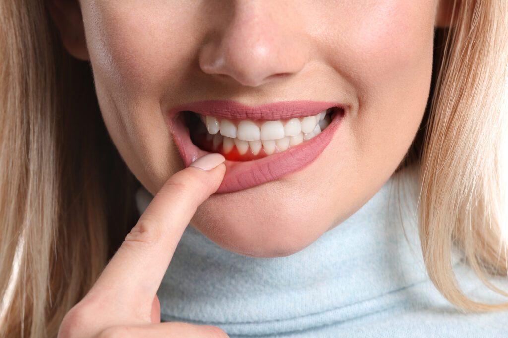 gum disease treatment bayswater - Close up woman with gum pain