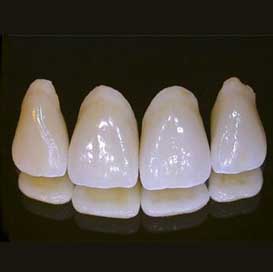 Top front four crowns on black background